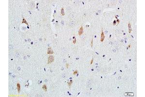 Formalin-fixed and paraffin embedded rat brain tissue labeled with Rabbit Anti-NGF-beta Polyclonal Antibody  at 1:200 followed by conjugation to the secondary antibody and DAB staining.