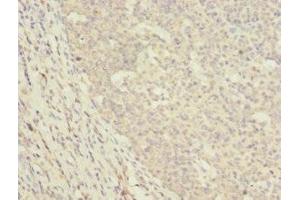 Immunohistochemistry of paraffin-embedded human tonsil tissue using ABIN7150497 at dilution of 1:100 (DNAJA2 抗体  (AA 233-412))