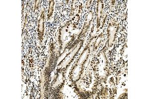 IHC analysis of RCC1 using anti-RCC1 antibody (ABIN7600024). (RCC1 抗体  (AA 14-421))