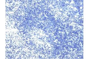 Cells treated with a phosphatase to eliminate all phosphorylation (LAT 抗体  (pTyr226))