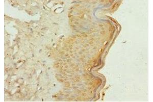 Immunohistochemistry of paraffin-embedded human skin tissue using ABIN7163882 at dilution of 1:100 (GALNT3 抗体  (AA 1-140))