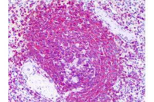 Anti-RICTOR antibody IHC of human spleen. (RICTOR 抗体  (AA 1-99))