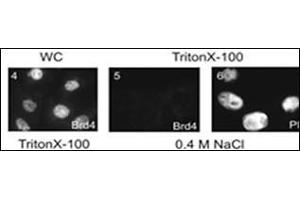 Subnuclear distribution of cellular proteins. (BRD4 抗体  (C-Term))