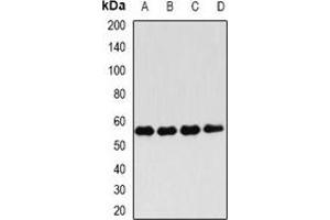 Western blot analysis of FKBP4 expression in Hela (A), Jurkat (B), MCF7 (C), mouse testis (D) whole cell lysates. (FKBP4 抗体)