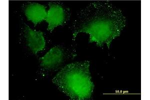 Immunofluorescence of monoclonal antibody to CNOT7 on HeLa cell. (CNOT7 抗体  (AA 1-285))