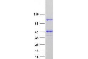 UBXN11 Protein (Transcript Variant 3) (Myc-DYKDDDDK Tag)