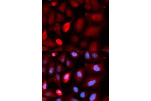 Immunofluorescence analysis of U2OS cells using PDLIM5 antibody. (PDLIM5 抗体  (AA 317-596))