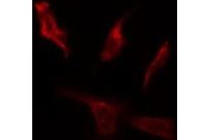 ABIN6267064 staining HepG2 by IF/ICC. (AKT 1/2/3 抗体  (pTyr312, pTyr315, pTyr316))