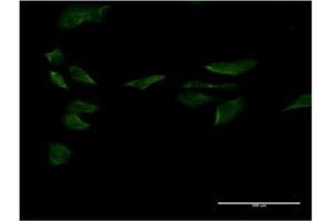 Immunofluorescence of monoclonal antibody to SP1 on HeLa cell. (SP1 抗体  (AA 522-618))
