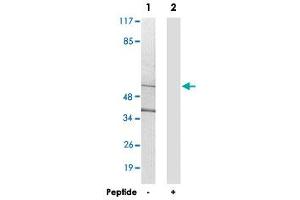 Western blot analysis of extracts from 293 cells, using CYP21A2 polyclonal antibody . (CYP21A2 抗体)