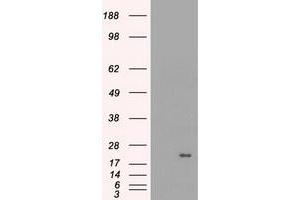 HEK293T cells were transfected with the pCMV6-ENTRY control (Left lane) or pCMV6-ENTRY CRYAB (Right lane) cDNA for 48 hrs and lysed. (CRYAB 抗体)