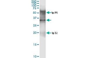 Immunoprecipitation of AMT transfected lysate using anti-AMT MaxPab rabbit polyclonal antibody and Protein A Magnetic Bead , and immunoblotted with AMT MaxPab rabbit polyclonal antibody (D01) . (Aminomethyltransferase 抗体  (AA 1-289))
