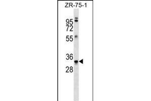 MBP Antibody (Ascites) ABIN1539854 western blot analysis in ZR-75-1 cell line lysates (35 μg/lane). (MBP 抗体)