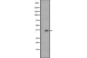 Western blot analysis of OR2M4 expression in Jurkat whole cell lysate ,The lane on the left is treated with the antigen-specific peptide. (OR2M4 抗体)