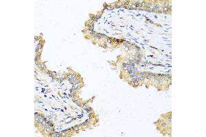 Immunohistochemistry of paraffin-embedded human prostate using DEFB121 antibody at dilution of 1:100 (40x lens). (DEFB121 抗体)