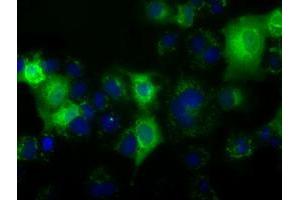 Anti-C17orf28 mouse monoclonal antibody (ABIN2452858) immunofluorescent staining of COS7 cells transiently transfected by pCMV6-ENTRY C17orf28 (RC206740). (HID1/DMC1 抗体)
