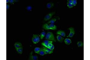 Immunofluorescence staining of MCF-7 cells with ABIN7174125 at 1:133, counter-stained with DAPI. (SIRPA 抗体  (AA 31-373))