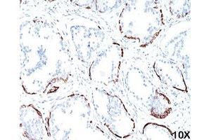 IHC staining of human prostate (10X) with HMW Cytokeratin antibody (34bE12). (KRT1 抗体)