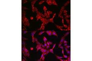 Immunofluorescence analysis of PC-12 cells using LDHA Rabbit mAb  at dilution of 1:100 (40x lens). (Lactate Dehydrogenase A 抗体)