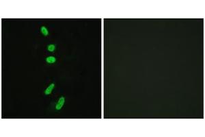 Immunofluorescence analysis of HeLa cells, using SF1 (epitope around residue 82) antibody. (Splicing Factor 1 抗体  (Ser82))
