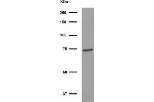 Western blot analysis of FOXJ3 Antibody expression in HepG2 cells lysates. (FOXJ3 抗体  (C-Term))