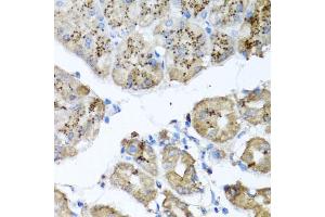 Immunohistochemistry of paraffin-embedded human stomach using PPOX antibody (ABIN5973799) at dilution of 1/100 (40x lens). (PPOX 抗体)