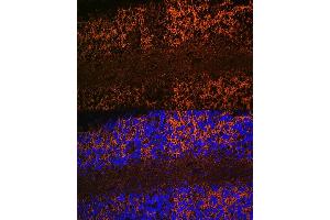 Immunofluorescence analysis of rat brain using Aquaporin-4 (Aquaporin-4 ) Rabbit mAb (ABIN7265653) at dilution of 1:100 (40x lens). (Aquaporin 4 抗体)
