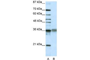 WB Suggested Anti-TLX2 Antibody Titration:  2. (TLX2 抗体  (C-Term))