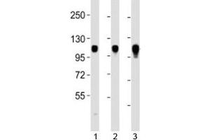 Western blot testing of Integrin alpha 7 antibody at 1:2000 dilution. (ITGA7 抗体  (C-Term))