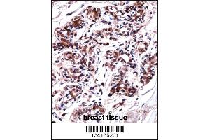 UBP1 Antibody immunohistochemistry analysis in formalin fixed and paraffin embedded human breast tissue followed by peroxidase conjugation of the secondary antibody and DAB staining. (UBP1 抗体  (AA 266-295))