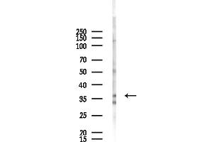 anti-Methylenetetrahydrofolate Dehydrogenase (NADP+ Dependent) 2, Methenyltetrahydrofolate Cyclohydrolase (MTHFD2) (N-Term) antibody