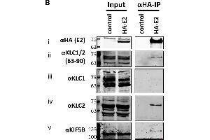 Endogenous KLC2 co-immunoprecipitates with E2. (KLC1 抗体)