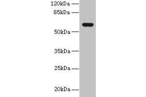 Western blot All lanes: KATNAL2 antibody at 1 μg/mL + U251 whole cell lysate Secondary Goat polyclonal to rabbit IgG at 1/10000 dilution Predicted band size: 62, 53 kDa Observed band size: 62 kDa (KATNAL2 抗体  (AA 18-307))