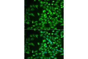 Immunofluorescence analysis of U2OS cells using LRAT antibody (ABIN6132019, ABIN6143313, ABIN6143316 and ABIN6222345). (LRAT 抗体  (AA 1-194))