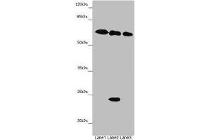 Western blot All lanes: TOX3 antibody at 9 μg/mL Lane 1: Mouse heart tissue Lane 2: Mouse spleen tissue Lane 3: Mouse brain tissue Secondary Goat polyclonal to rabbit IgG at 1/10000 dilution Predicted band size: 63 kDa Observed band size: 63, 24 kDa (TOX3 抗体  (AA 8-305))