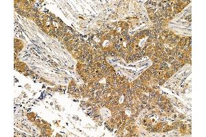 ABIN7096016 and ABIN7100078 at 1/100 staining rat pancreatic tissue by IHC-P.
