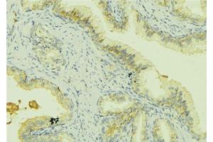 ABIN6273068 at 1/100 staining Mouse colon tissue by IHC-P. (PRSS8 抗体  (Internal Region))