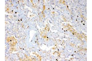 IHC analysis of Psoriasin using anti-Psoriasin antibody . (S100A7 抗体  (AA 2-101))