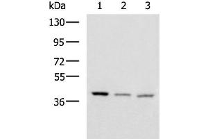 Western blot analysis of Human cerebrum tissue Human cerebella tissue Mouse brain tissue lysates using ENKD1 Polyclonal Antibody at dilution of 1:1150 (ENKD1 抗体)