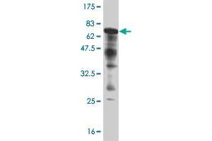 Western Blot detection against Immunogen (68. (ANGPTL4 抗体  (AA 26-406))