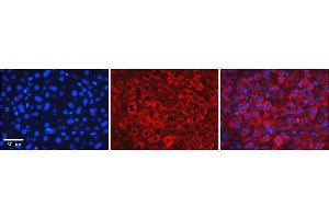 Immunohistochemistry (IHC) image for anti-ZFP36 Ring Finger Protein-Like 1 (ZFP36L1) (Middle Region) antibody (ABIN2780624)