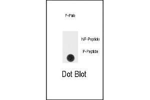 Dot blot analysis of anti-Phospho-SPRY4-pY75 Antibody (ABIN389968 and ABIN2839764) on nitrocellulose membrane.