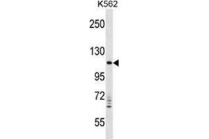 VPS11 Antibody (C-term) western blot analysis in K562 cell line lysates (35 µg/lane). (VPS11 抗体  (C-Term))