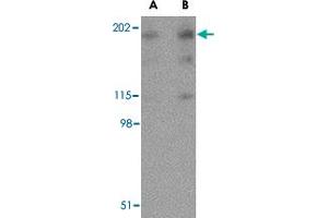 Western blot analysis of RTN4 in human brain tissue lysate with RTN4 polyclonal antibody  at (A) 0. (Reticulon 4 抗体  (Internal Region))