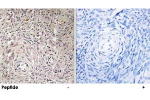 Immunohistochemistry analysis of paraffin-embedded human ovary tissue using GCNT7 polyclonal antibody . (GCNT7 抗体)