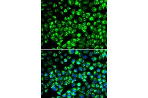 Immunofluorescence analysis of HeLa cells using ATP6AP2 antibody.