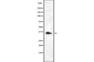 Western blot analysis OR9G1 using K562 whole cell lysates (OR9G1 抗体  (Internal Region))