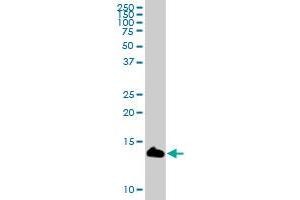 LY6D MaxPab polyclonal antibody. (LY6D 抗体  (AA 1-128))