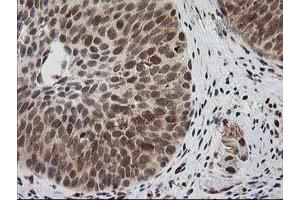 Image no. 13 for anti-Excision Repair Cross-Complementing Rodent Repair Deficiency, Complementation Group 4 (ERCC4) antibody (ABIN1498070)
