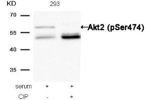 Western blot analysis of extracts from 293 cells, treated with serum or calf intestinal phosphatase (CIP), using Akt2 (Phospho-Ser474) Antibody.